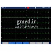 دستگاه-نوار-قلب-سه-کانال-زونکر-مدل-iMAC-300