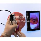 مولاژ-پیشرفته-مدیریت-راه-هوایی-مولاژ-انتوباسیون---برند-مدیسا