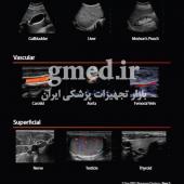 دستگاه-اکوکاردیوگرافی-زونر-ZONARE--مدل-ZONE-PRO-ساخت-امریکا